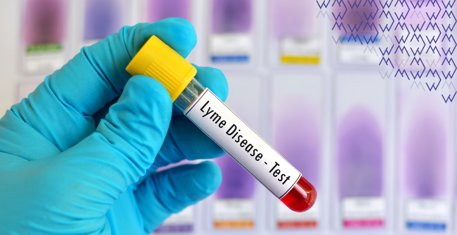 test borelioza