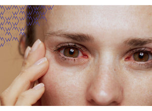 Unavené oči z obrazoviek? Spoznajte riešenie na syndróm suchého oka